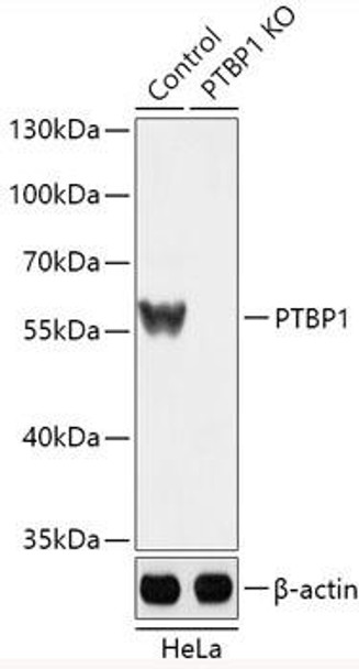 KO Validated Antibodies 1 Anti-PTBP1 Antibody CAB18084KO Validated
