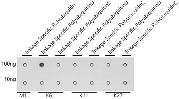 Cell Biology Antibodies 14 Anti-K6-linkage Specific Polyubiquitin Antibody CAB18106