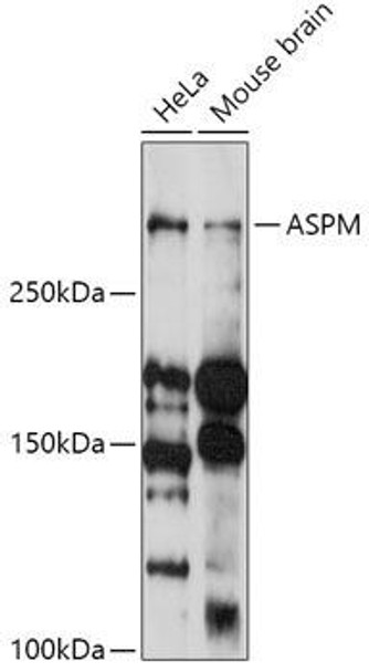 Cell Biology Antibodies 14 Anti-ASPM Antibody CAB18147