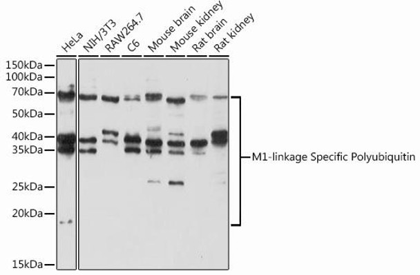 Cell Biology Antibodies 14 Anti-M1-linkage Specific Polyubiquitin Antibody CAB18200