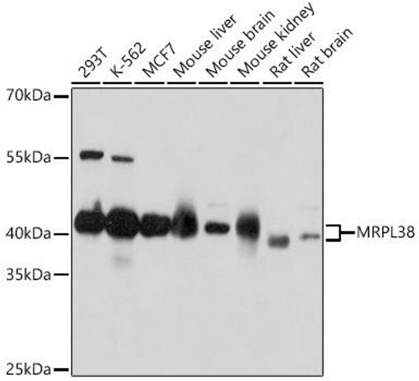 Cell Biology Antibodies 18 Anti-MRPL38 Antibody CAB18239