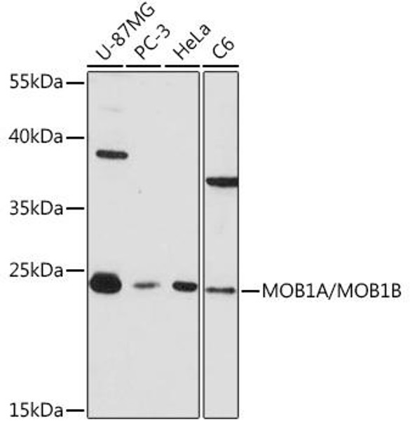 Cell Biology Antibodies 18 Anti-MOB1A/MOB1B Antibody CAB18246