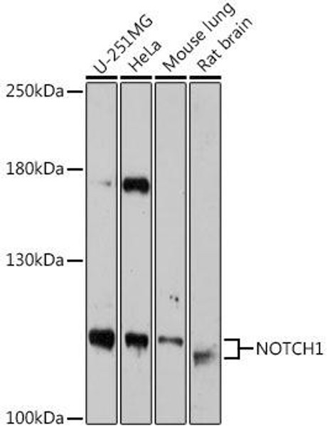 Cardiovascular Antibodies Anti-NOTCH1 Antibody CAB18282