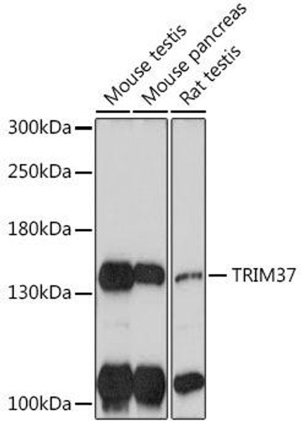 Cell Biology Antibodies 18 Anti-TRIM37 Antibody CAB18307