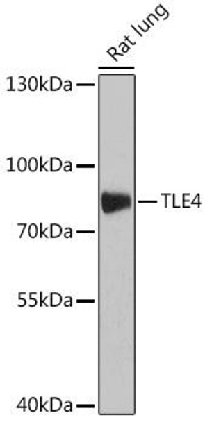 Cell Biology Antibodies 18 Anti-TLE4 Antibody CAB18345