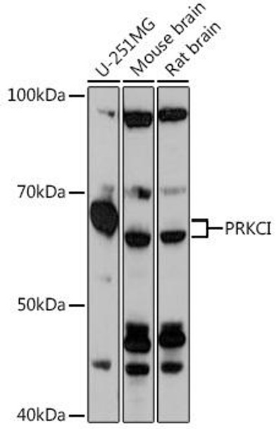 Cell Biology Antibodies 18 Anti-PRKCI Antibody CAB18348