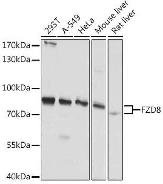 Cell Biology Antibodies 18 Anti-FZD8 Antibody CAB18393