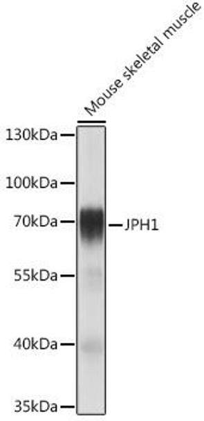 Cell Biology Antibodies 17 Anti-JPH1 Antibody CAB18476
