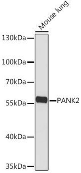Cell Biology Antibodies 17 Anti-PANK2 Antibody CAB18502