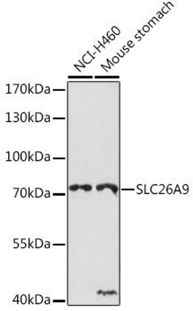 Cell Biology Antibodies 15 Anti-SLC26A9 Antibody CAB18530