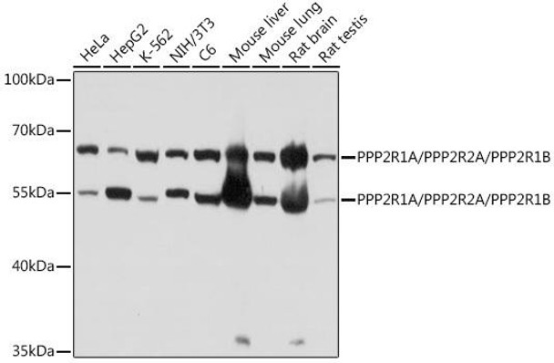 Cell Biology Antibodies 15 Anti-PPP2R1A/PPP2R2A/PPP2R1B Antibody CAB18571