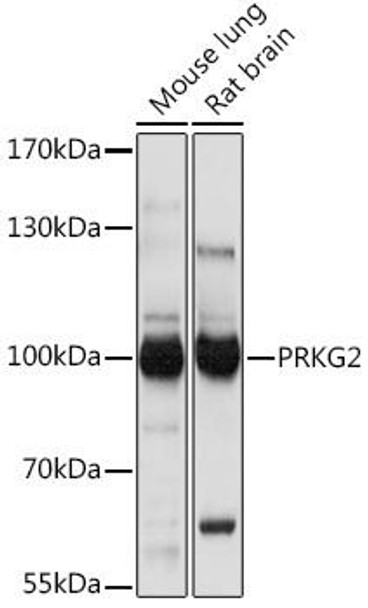 Cell Biology Antibodies 15 Anti-PRKG2 Antibody CAB18575