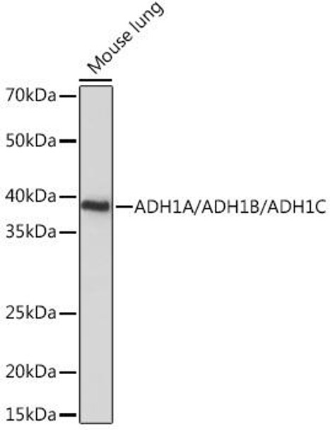 Cell Biology Antibodies 15 Anti-ADH1A/ADH1B/ADH1C Antibody CAB18581