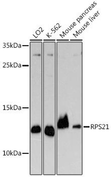 Cell Biology Antibodies 15 Anti-RPS21 Antibody CAB18585