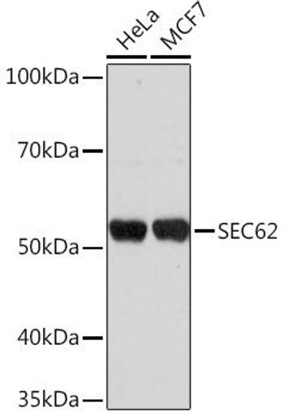 Cell Biology Antibodies 15 Anti-SEC62 Antibody CAB18589