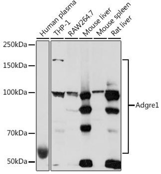 Cell Biology Antibodies 15 Anti-Adgre1 Antibody CAB18637