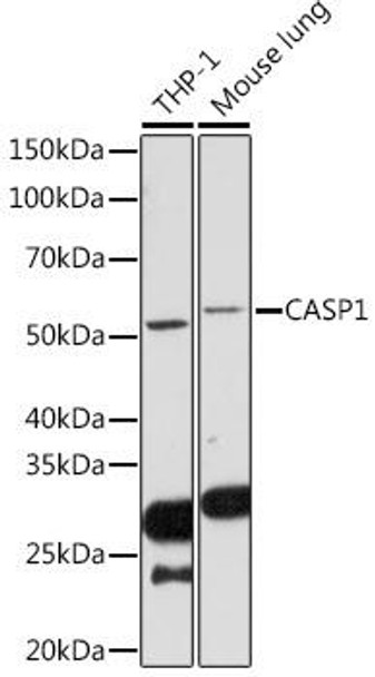 KO Validated Antibodies 2 Anti-CASP1 Antibody CAB18646KO Validated