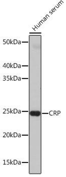 Immunology Antibodies 3 Anti-CRP Antibody CAB19003