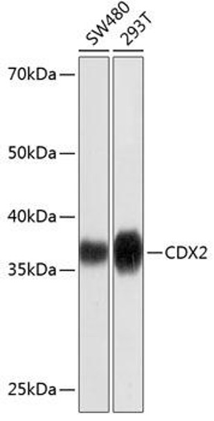Epigenetics and Nuclear Signaling Antibodies 5 Anti-CDX2 Antibody CAB19030