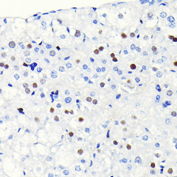 KO Validated Antibodies 2 Anti-Cyclin D1 Antibody KO Validated CAB19038