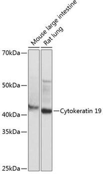 Immunology Antibodies 3 Anti-Cytokeratin 19 Antibody CAB19040