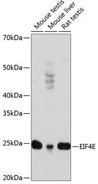 Immunology Antibodies 3 Anti-EIF4E Antibody CAB19044