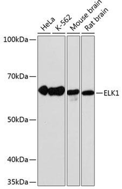 Epigenetics and Nuclear Signaling Antibodies 5 Anti-ELK1 Antibody CAB19046