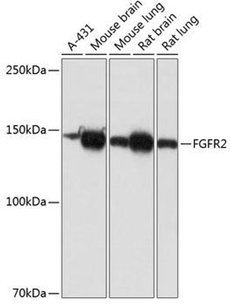 Cell Death Antibodies 2 Anti-FGFR2 Antibody CAB19051