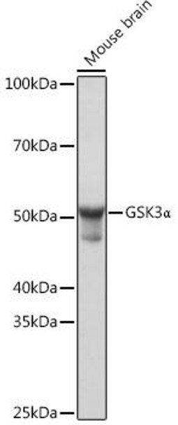 KO Validated Antibodies 2 Anti-GSK3Alpha Antibody KO Validated CAB19060