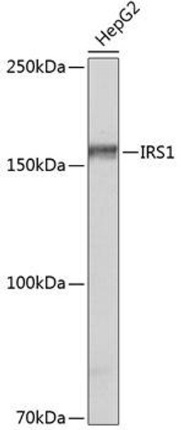 Cell Biology Antibodies 17 Anti-IRS1 Antibody CAB19074