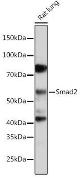 KO Validated Antibodies 2 Anti-Smad2 Antibody KO Validated CAB19114