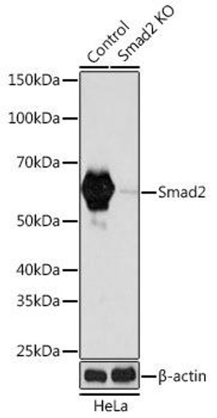 KO Validated Antibodies 2 Anti-Smad2 Antibody KO Validated CAB19114