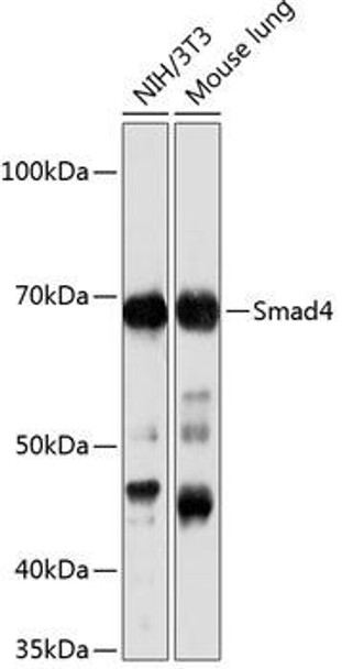 KO Validated Antibodies 2 Anti-Smad4 Antibody KO Validated CAB19116