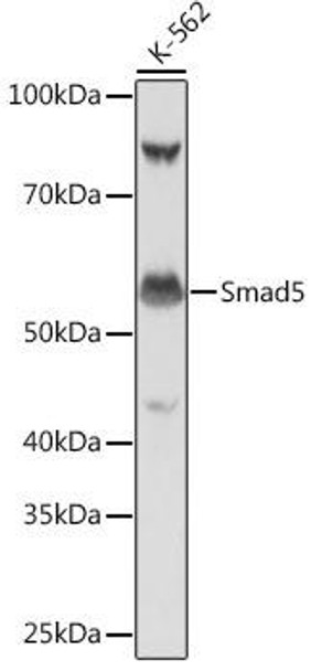 KO Validated Antibodies 2 Anti-Smad5 Antibody KO Validated CAB19117