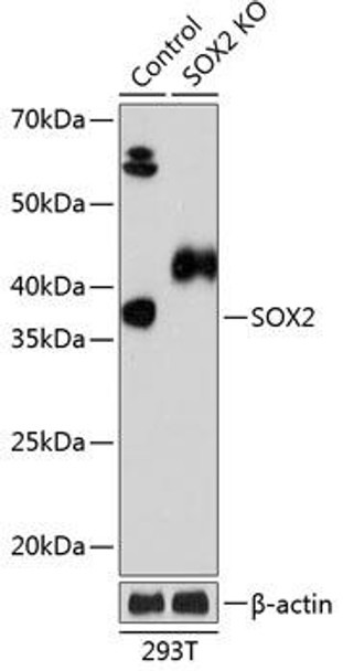 KO Validated Antibodies 2 Anti-SOX2 Antibody KO Validated CAB19118