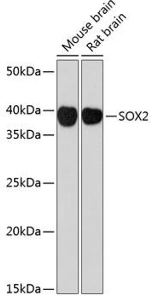 KO Validated Antibodies 2 Anti-SOX2 Antibody KO Validated CAB19118