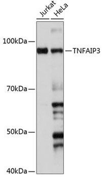 Cell Death Antibodies 2 Anti-TNFAIP3 Antibody CAB19128