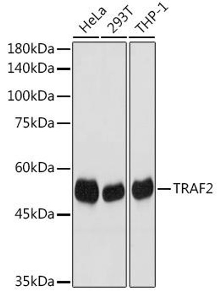 Cell Death Antibodies 2 Anti-TRAF2 Antibody CAB19129