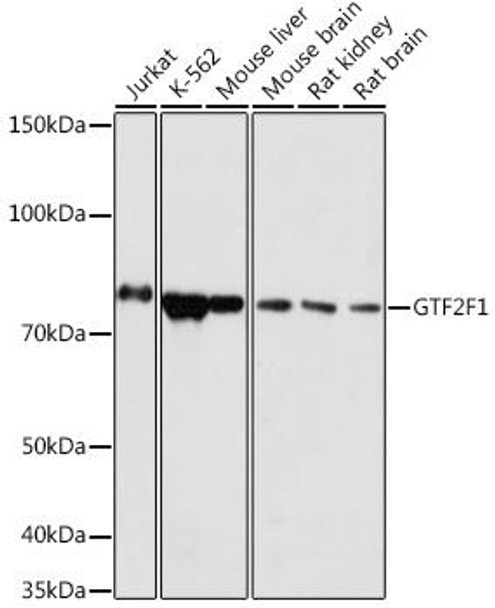 Epigenetics and Nuclear Signaling Antibodies 5 Anti-GTF2F1 Antibody CAB19315