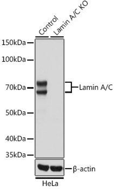 KO Validated Antibodies 2 Anti-Lamin A/C Antibody KO Validated CAB19524