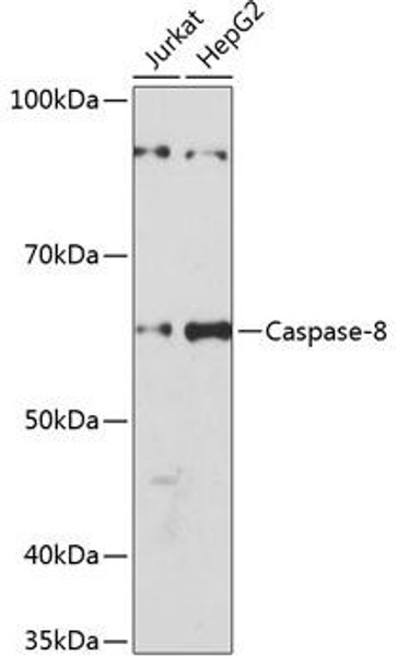 KO Validated Antibodies 2 Anti-Caspase-8 Antibody KO Validated CAB19549
