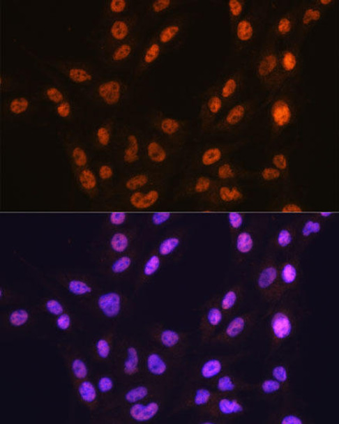 KO Validated Antibodies 2 Anti-CTCF Antibody KO Validated CAB19588