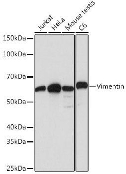 KO Validated Antibodies 2 Anti-Vimentin Antibody KO Validated CAB19607