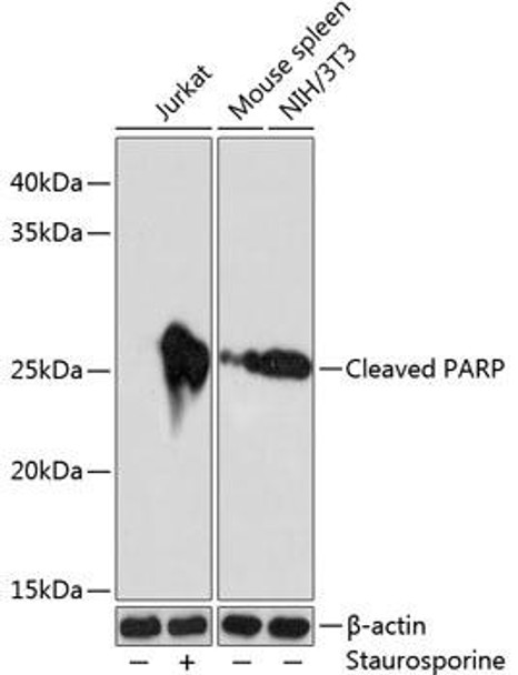 KO Validated Antibodies 2 Anti-Cleaved PARP p25 Antibody KO Validated CAB19612