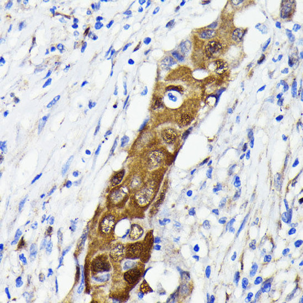 KO Validated Antibodies 2 Anti-NF-kB p65 Antibody KO Validated CAB19653