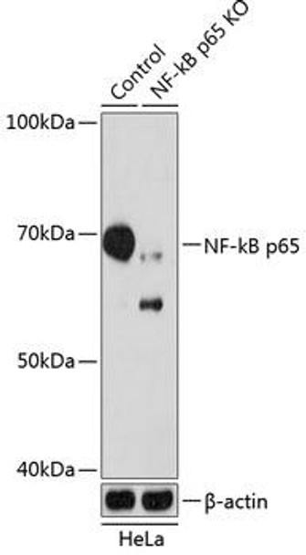 KO Validated Antibodies 2 Anti-NF-kB p65 Antibody KO Validated CAB19653