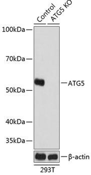 KO Validated Antibodies 2 Anti-ATG5 Antibody KO Validated CAB19677