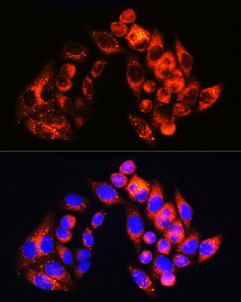 KO Validated Antibodies 2 Anti-SQSTM1 / p62 Antibody KO Validated CAB19700