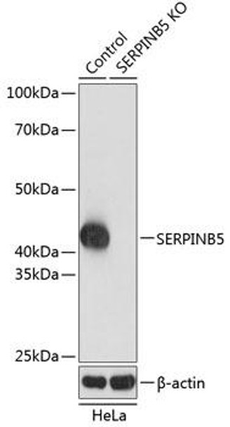 KO Validated Antibodies 2 Anti-SERPINB5 Antibody CAB19848KO Validated