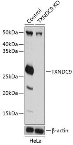 KO Validated Antibodies 2 Anti-TXNDC9 Antibody CAB19869KO Validated